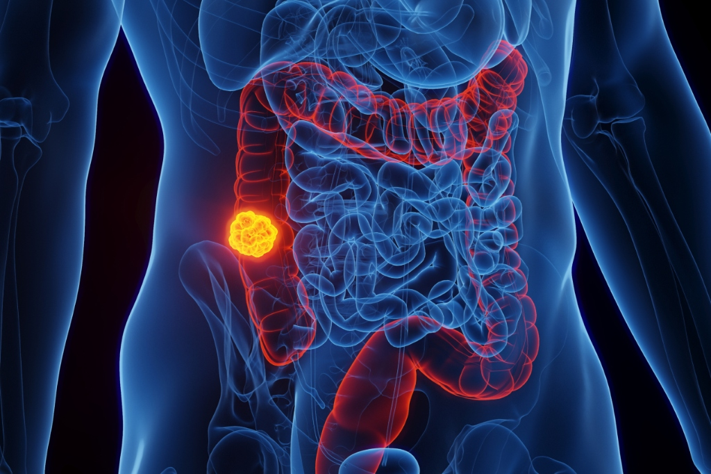 대장내시경 정의 이미지