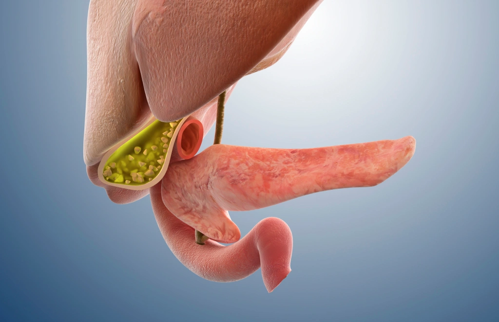 담낭·담도 질환