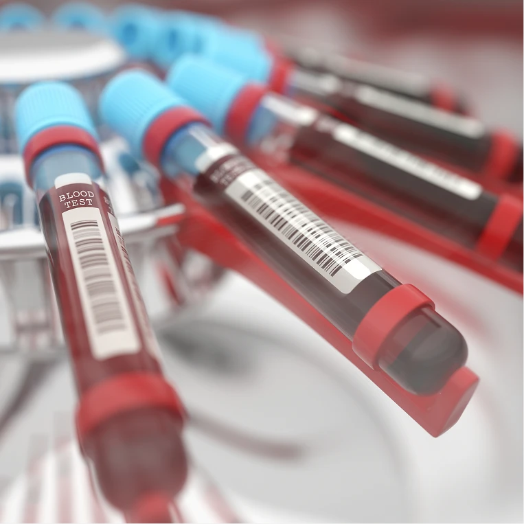 혈액검사(염증·자가항체)