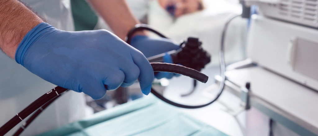 위내시경 검사 이미지