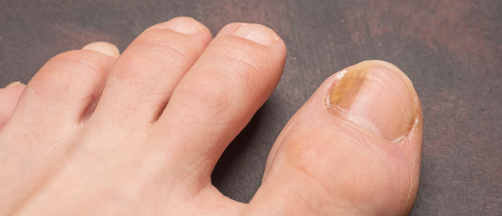 손발톱 클리닉 메인 이미지