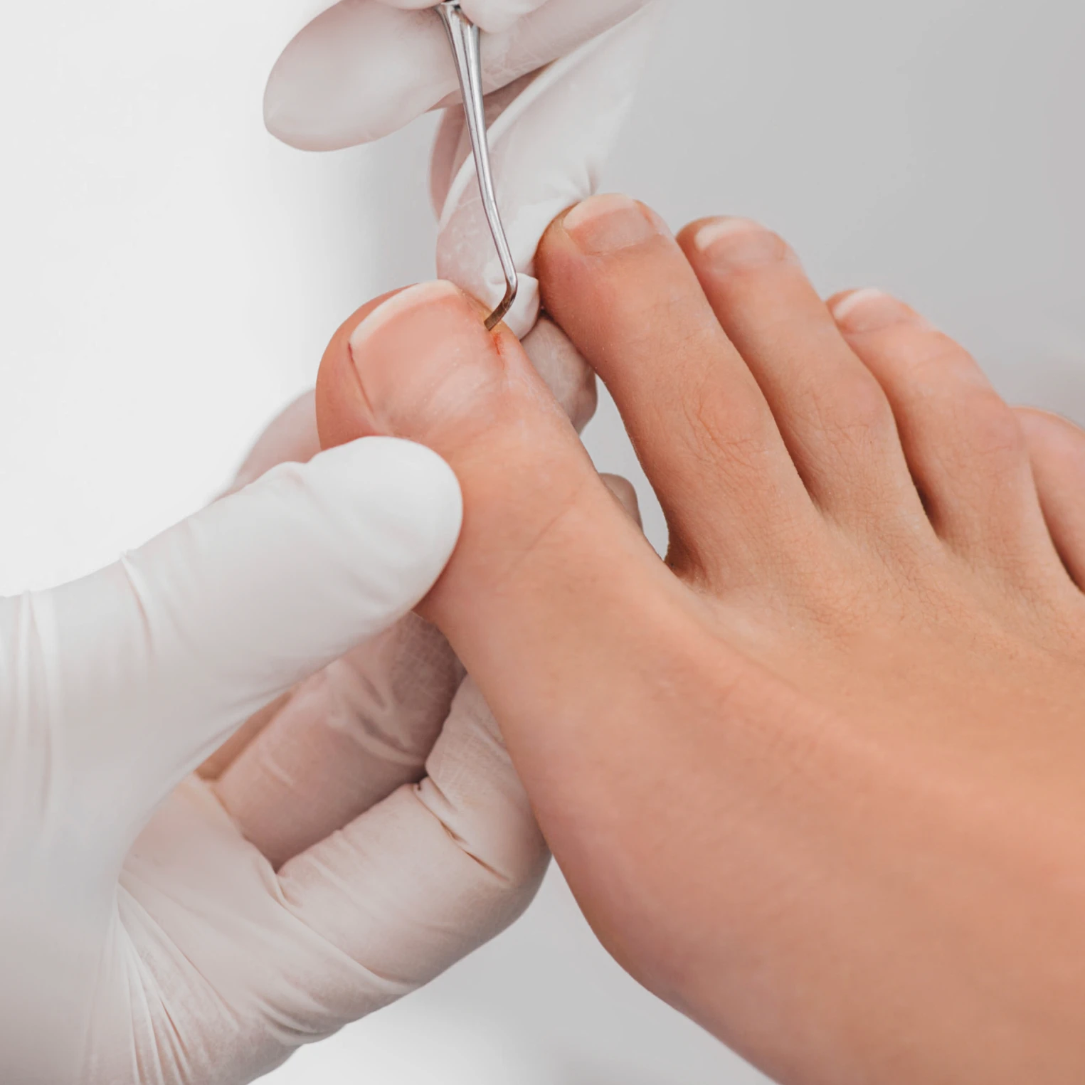 빠른 시술, 바로 일상으로