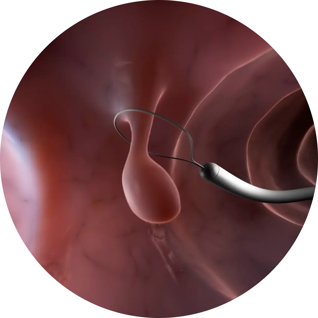 검진부터 치료까지 원스톱