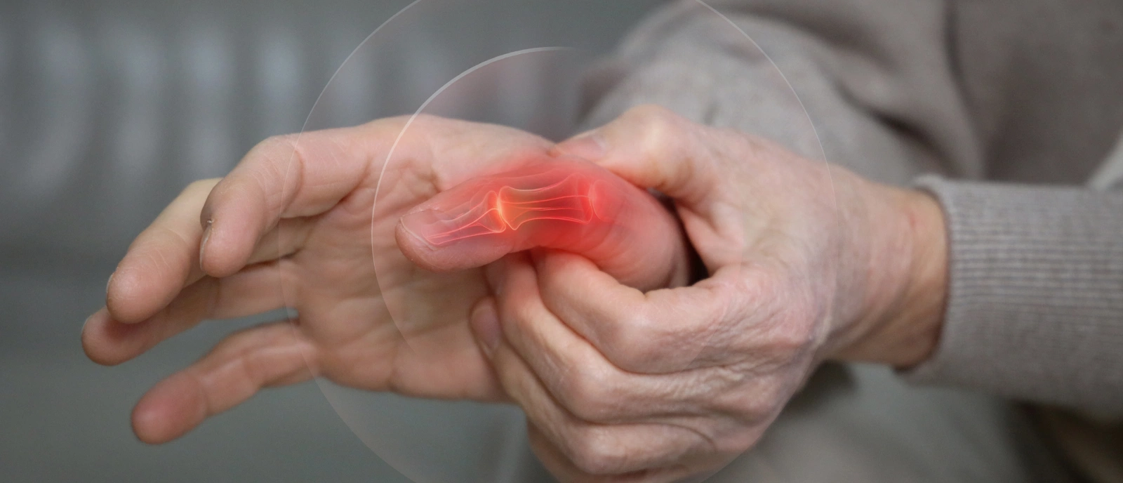 류마티스관절염 증상 이미지