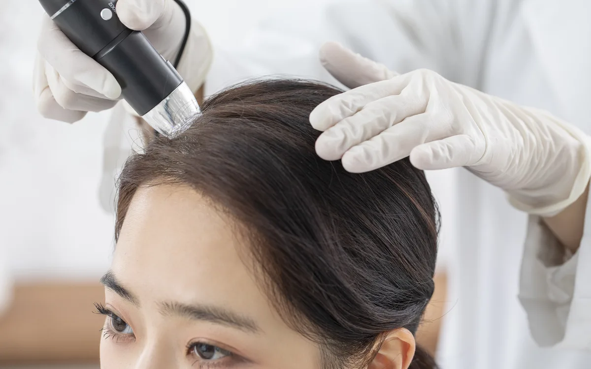 의료진이 두피 확대경으로 여성 환자의 두피를 살펴보는 모습